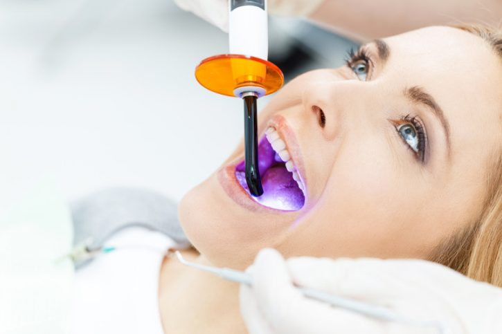 tratamiento-blanquemiento-dental-terrassa