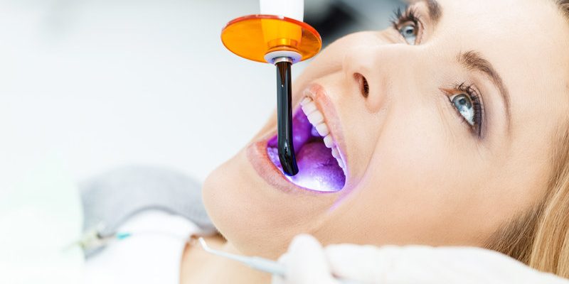 tratamiento-blanquemiento-dental-terrassa