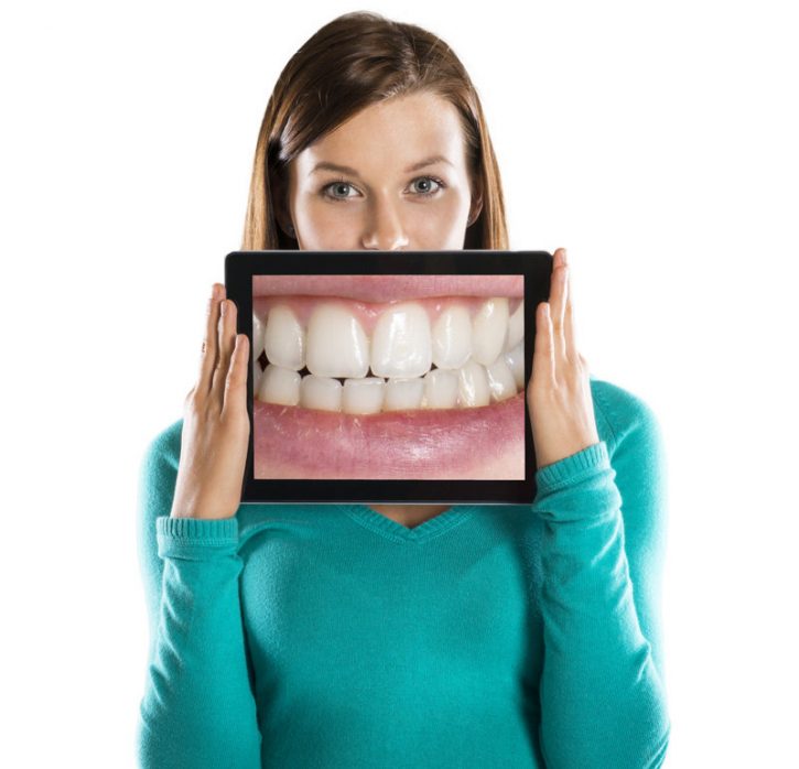 ventajas-endodonci-conservadora