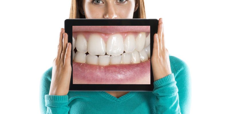 ventajas-endodonci-conservadora