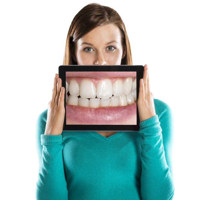 ventajas-endodonci-conservadora